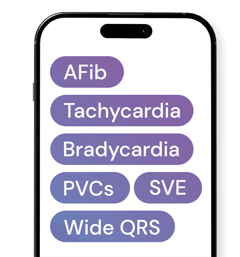 Advanced ECG analysis